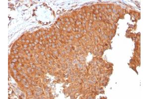 Immunohistochemistry (IHC) image for anti-SERPINE1 mRNA Binding Protein 1 (SERBP1) (AA 3-139) antibody (ABIN6939489)