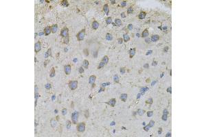 Immunohistochemistry of paraffin-embedded mouse brain using DBI Antibody. (Diazepam Binding Inhibitor Antikörper)