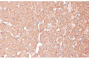 Immunohistochemistry of paraffin-embedded Rat heart using FRMD6 Polyclonal Antibody at dilution of 1:100 (40x lens).