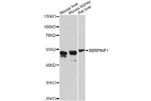 Western blot analysis of extracts of various cell lines, using SERPINF1 antibody (ABIN4905126) at 1:3000 dilution. (PEDF Antikörper)