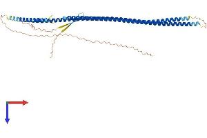 Keratin 27 (KRT27) (AA 1-448) protein (His tag)