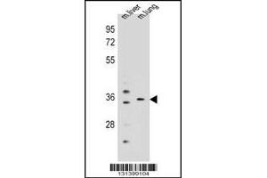 Western blot analysis in mouse liver,lung tissue lysates (35ug/lane).