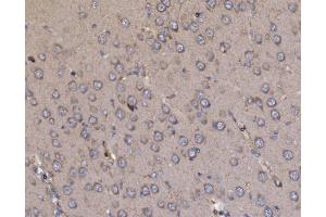 IHC analysis of NDUFAF1 using anti-NDUFAF1 antibody (ABIN7602459).