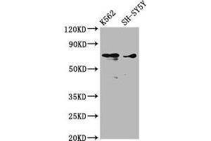 Western Blot Positive WB detected in: K562 whole cell lysate, SH-SY5Y whole cell lysate All lanes: ALOX12 antibody at 3. (ALOX12 Antikörper  (AA 508-658))