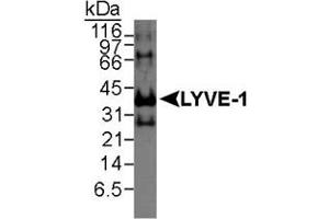 Western blot analysis of LYVE1 in recombinant human protein using LYVE1 polyclonal antibody . (LYVE1 Antikörper  (AA 250-322))