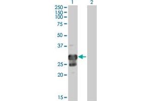 Western Blot analysis of TPPP expression in transfected 293T cell line by TPPP MaxPab polyclonal antibody. (Tppp Antikörper  (AA 1-219))