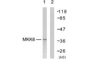 Western blot analysis of extract from MDA-MB-435 cells, using MKK6 (Ab-207) antibody (E021153). (MAP2K6 Antikörper)