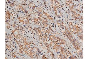 Immunohistochemistry (IHC) image for anti-Junction Plakoglobin (JUP) (C-Term) antibody (ABIN6260497)