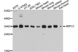 Western blot analysis of extracts of various cell lines, using ARPC2 antibody (ABIN4902949) at 1:1000 dilution. (ARPC2 Antikörper)