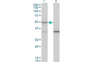 Western Blot analysis of SMAD3 expression in transfected 293T cell line by SMAD3 monoclonal antibody (M02), clone 7F3.