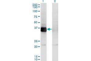 Western Blot analysis of PHF11 expression in transfected 293T cell line by PHF11 monoclonal antibody (M01), clone 3B8. (PHF11 Antikörper  (AA 1-292))