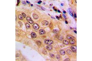 Immunohistochemistry (IHC) image for anti-Nuclear Factor of Activated T-Cells, Cytoplasmic, Calcineurin-Dependent 4 (NFATC4) (C-Term), (pSer676) antibody (ABIN7301056)