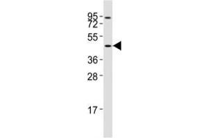 Western blot testing of CCR1 antibody at 1:2000 dilution + Jurkat lysate; Predicted band size : 40-45 kDa. (CCR1 Antikörper  (AA 343-355))
