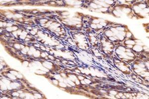 Immunohistochemistry analysis of paraffin-embedded mouse colon using,RRAGB (ABIN7075379) at dilution of 1: 4000