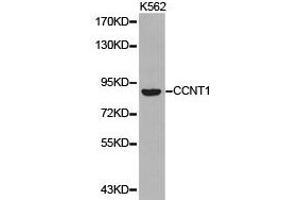 Western Blotting (WB) image for anti-Cyclin T1 (CCNT1) antibody (ABIN1871567) (Cyclin T1 Antikörper)