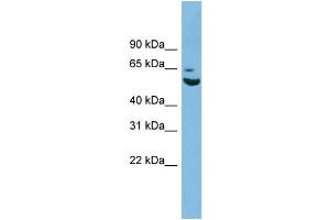 WB Suggested Anti-ZNF563 Antibody Titration: 0.
