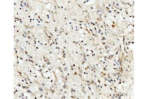 IHC analysis of RRP4/EXOSC2 using anti-RRP4/EXOSC2 antibody (ABIN7602188). (EXOSC2 Antikörper  (AA 62-293))