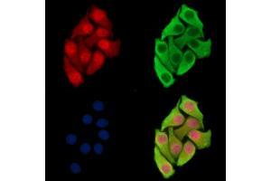 ABIN7096609 and ABIN7100673 staining Hela cells by IF/ICC.