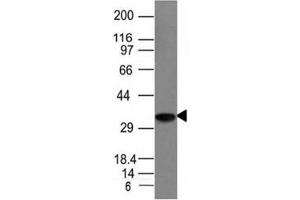 Western blot analysis of Raji cell lysate using CLIP antibody (CLIP/1133) (CLIP Antikörper)