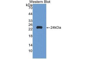 Western Blotting (WB) image for anti-Matrix Metallopeptidase 9 (Gelatinase B, 92kDa Gelatinase, 92kDa Type IV Collagenase) (MMP9) (AA 213-399) antibody (ABIN3201434) (MMP 9 Antikörper  (AA 213-399))