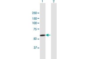 Western Blot analysis of LYN expression in transfected 293T cell line by LYN MaxPab polyclonal antibody.