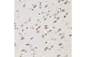 Immunohistochemistry of paraffin-embedded rat brain using BAZ1B antibody. (BAZ1B Antikörper)