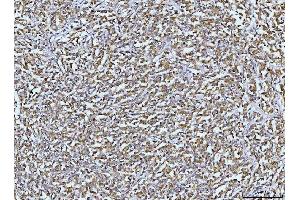 IHC analysis of DUSP6 using anti-DUSP6 antibody (ABIN7599332).