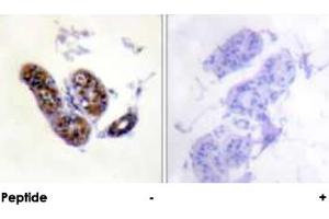 Immunohistochemical analysis of paraffin-embedded human skin tissue using MITF polyclonal antibody . (MITF Antikörper  (Ser73, Ser180))