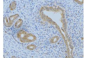 ABIN6275102 at 1/100 staining Human uterus tissue by IHC-P. (FBLN4 Antikörper  (Internal Region))