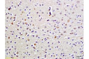 Formalin-fixed and paraffin embedded rat brain labeled with Anti-FUS Polyclonal Antibody, Unconjugated (ABIN682438) at 1:200 followed by conjugation to the secondary antibody and DAB staining (FUS Antikörper  (AA 421-526))