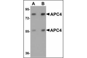 Western blot analysis of APC4 in mouse liver tissue lysate with APC4 antibody at (A) 1 and (B) 2 µg/ml. (ANAPC4 Antikörper  (N-Term))