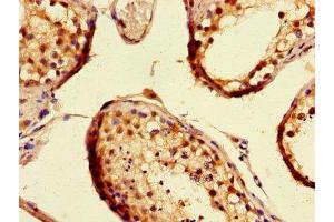 Immunohistochemistry of paraffin-embedded human testis tissue using ABIN7160045 at dilution of 1:100 (ASK1 Antikörper  (AA 363-431))