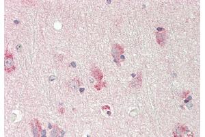 Rabbit Anti-ST6GALNAC1 antibody  Formalin Fixed Paraffin Embedded Tissue: Human Brain, Cortex Primary antibody Concentration: 1:100 Secondary Antibody: Donkey anti-Rabbit-Cy3 Secondary Antibody Concentration: 1:200 Magnification: 20x Exposure Time: 0.