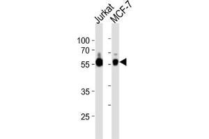 Western Blotting (WB) image for anti-Zinc Finger and SCAN Domain Containing 32 (ZSCAN32) antibody (ABIN3004600)