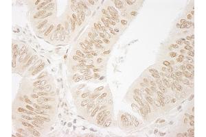 Immunohistochemistry (IHC) image for anti-Bromodomain PHD Finger Transcription Factor (BPTF) (AA 1350-1400) antibody (ABIN7448561)