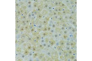 Immunohistochemistry of paraffin-embedded rat liver using SOX14 antibody (ABIN6292418) at dilution of 1:100 (40x lens).