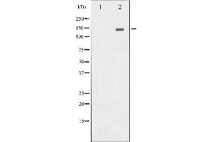 Western blot analysis of Met expression in HepG2 whole cell lysates,The lane on the left is treated with the antigen-specific peptide. (c-MET Antikörper  (C-Term))