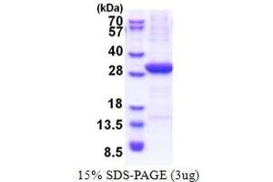 SDS-PAGE (SDS) image for V-Set Domain Containing T Cell Activation Inhibitor 1 (VTCN1) (AA 25-259) protein (His tag) (ABIN5853439) (VTCN1 Protein (AA 25-259) (His tag))