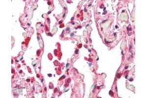 ABIN185097 (5µg/ml) staining of paraffin embedded Human Lung. (Centaurin beta 2 Antikörper  (C-Term))