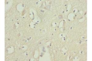 Immunohistochemistry of paraffin-embedded human brain tissue using ABIN7152580 at dilution of 1:100 (FASTK Antikörper  (AA 360-549))