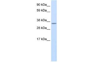 WB Suggested Anti-Use1 Antibody Titration:  0. (UBE2Z Antikörper  (N-Term))