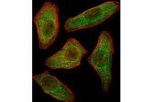 Fluorescent image of U251 cells stained with PIK3R3 Antibody . (PIK3R3 Antikörper  (C-Term))