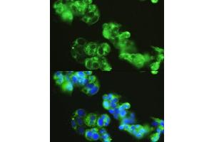 Immunofluorescence analysis of HepG2 cells using GOLG antibody (4688) at dilution of 1:150. (GOLGA1 Antikörper  (AA 1-300))
