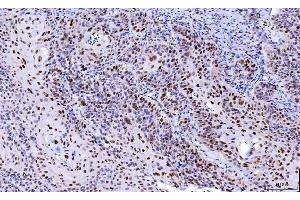 IHC analysis of Cdk2 using anti-Cdk2 antibody (ABIN7602522). (CDK2 Antikörper  (AA 81-298))