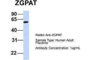 Host: Rabbit Target Name: ZGPAT Sample Type: Human Adult Placenta Antibody Dilution: 1.