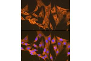 Immunofluorescence (IF) image for anti-Argininosuccinate Synthase 1 (ASS1) antibody (ABIN7265669)