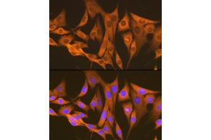 Immunofluorescence analysis of NIH-3T3 cells using  Rabbit mAb (ABIN7265669) at dilution of 1:100 (40x lens). (ASS1 Antikörper)