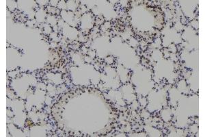 ABIN6278303 at 1/100 staining Mouse lung tissue by IHC-P. (Plakophilin 3 Antikörper  (C-Term))