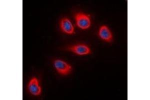 Immunofluorescent analysis of RPS6 staining in HeLa cells. (RPS6 Antikörper  (C-Term))
