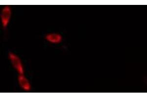 ABIN6276306 staining  Hela cells by IF/ICC. (Cytochrome C Antikörper  (N-Term))